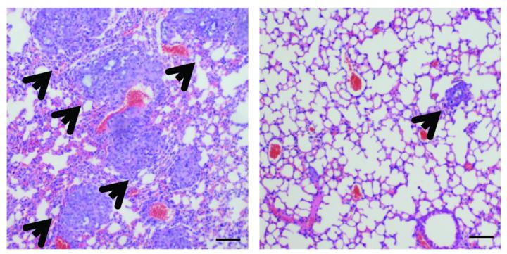 Epalrestat Inhibits Metastasis