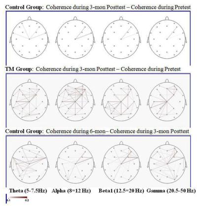 Coherence Difference Maps (Brain Connectivity)