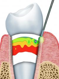 Cylindrical Geometry of the Periodontal Ligament