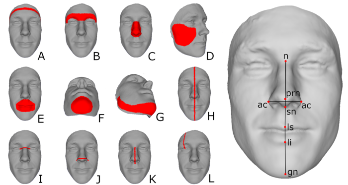 3D Facial Imaging for Gender-Affirming Surgery