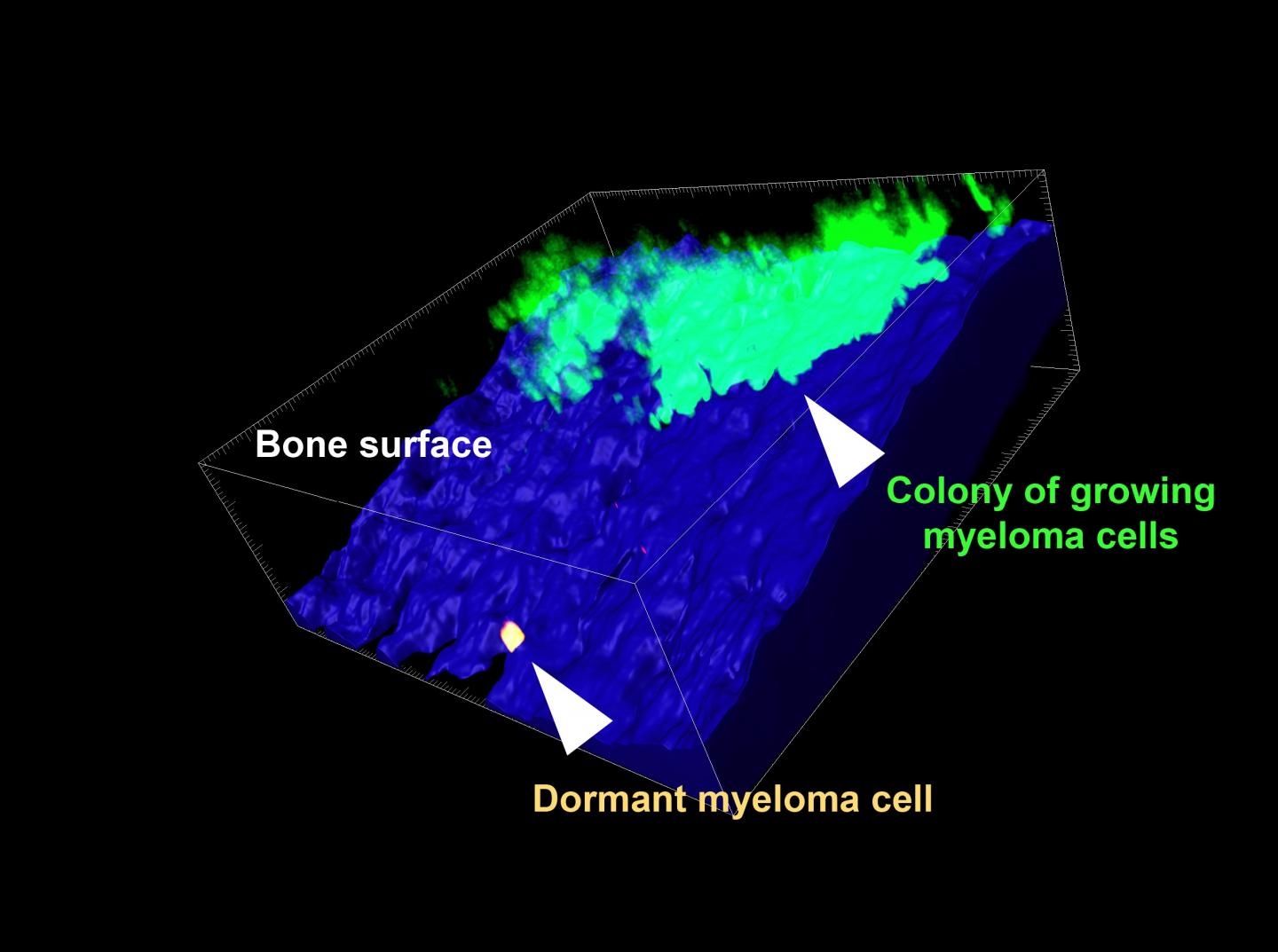 Researchers Have Identified What Keeps Some Cancer Cells Dormant (1 of 2)