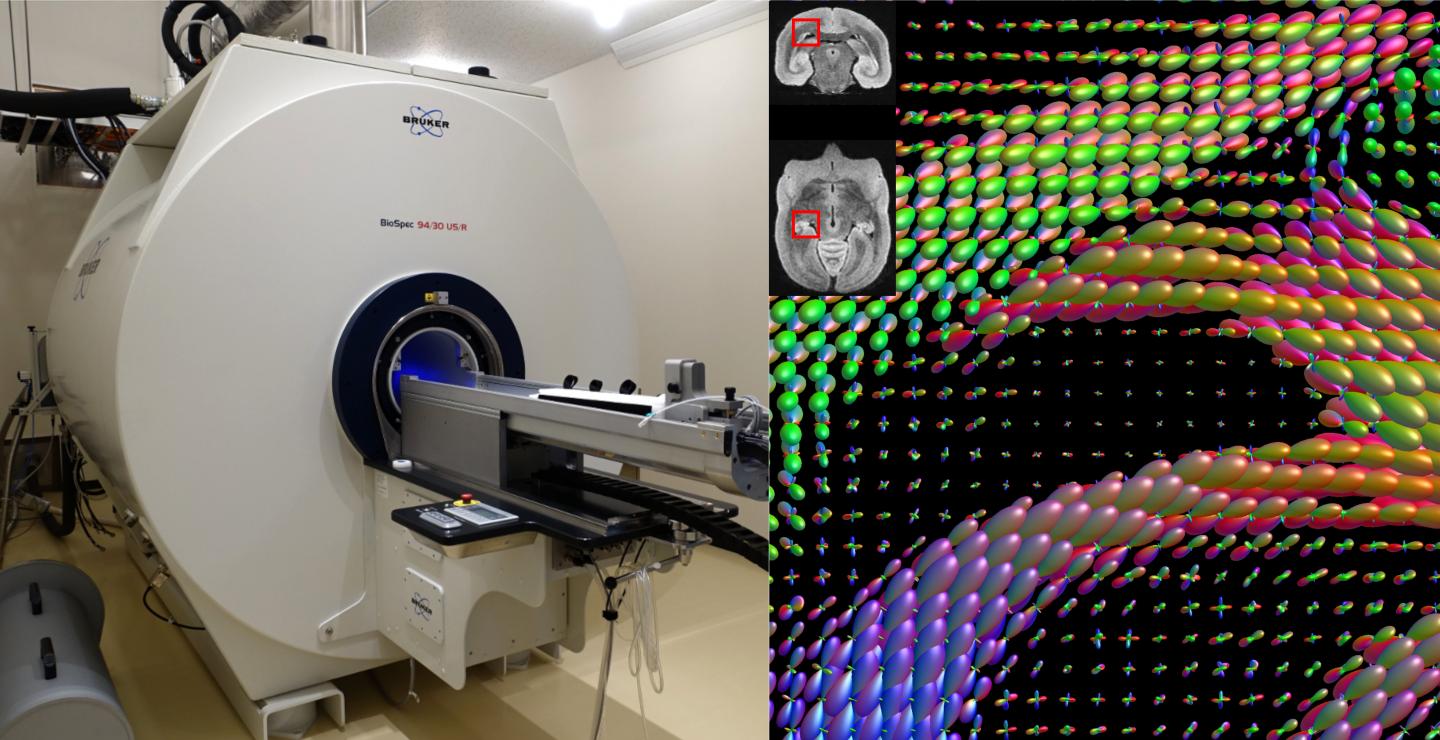 The MRI scanner at RIKEN and an example of diffusion MRI data