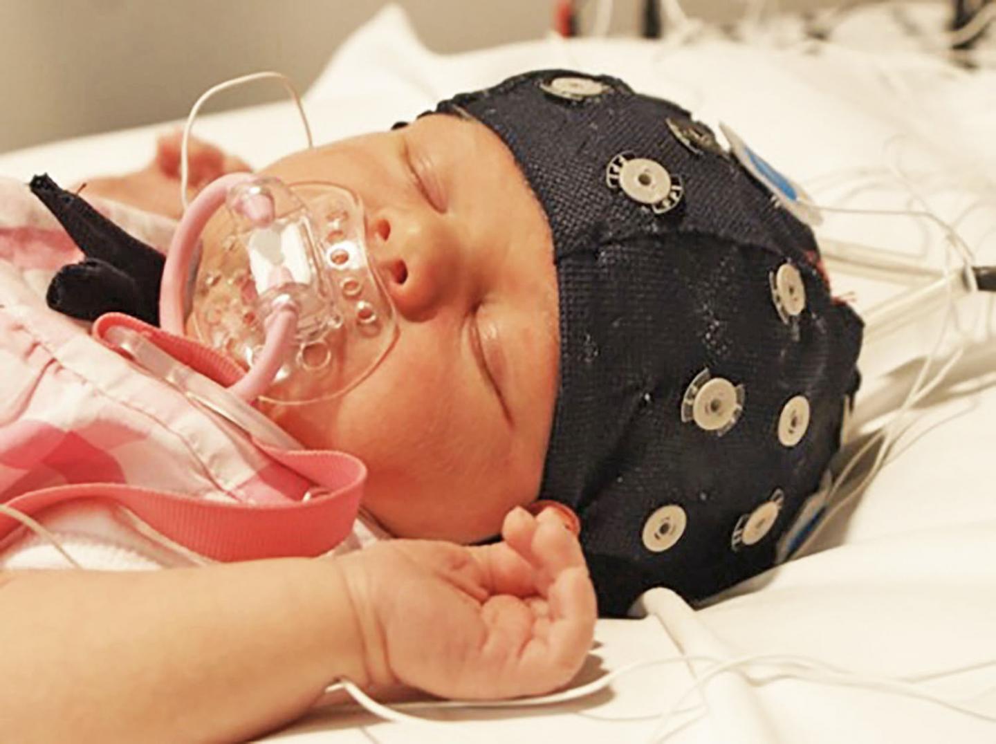 Machine Learning and Artificial Intelligence to Help Preterm Infants