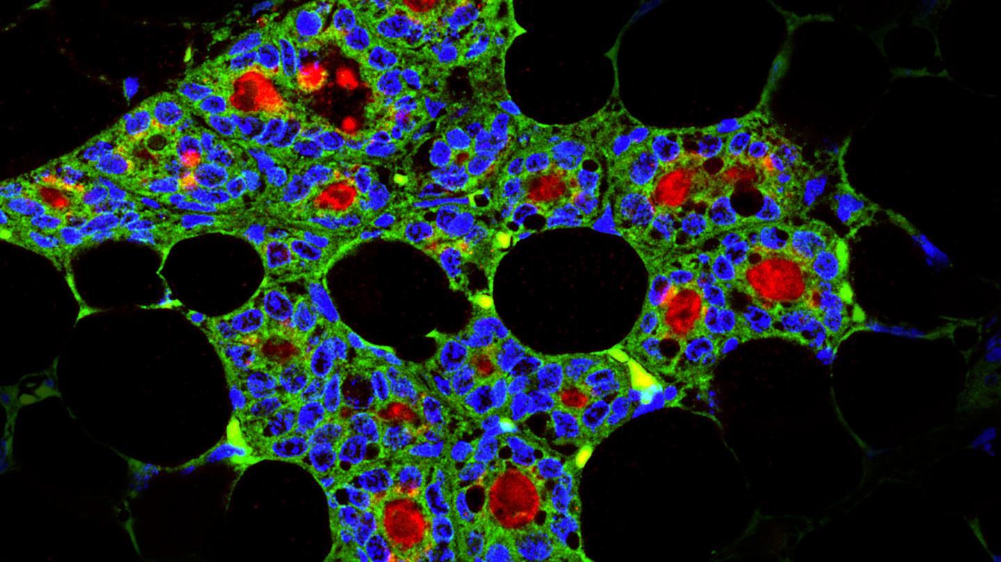 Dental Stem Cells Regenerating Mammary Gland