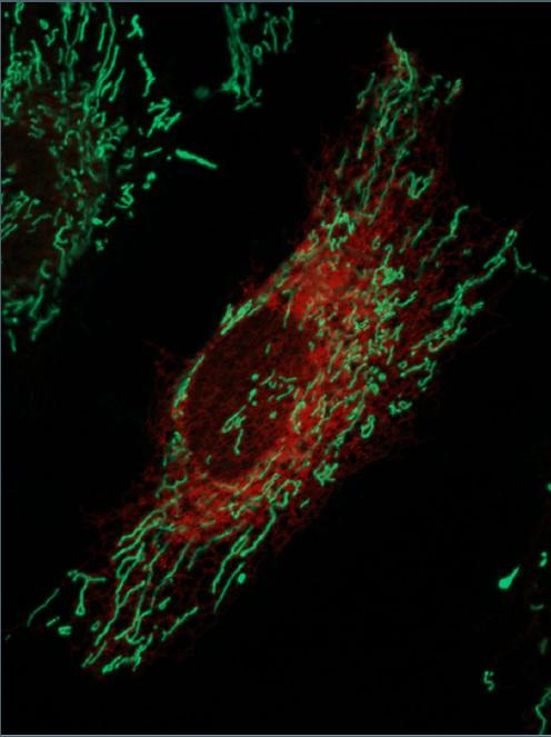 Live Imaging of ER and Mitochondria