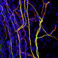Acetylated Tubulin in Sensory Neuron Endings in the Cornea