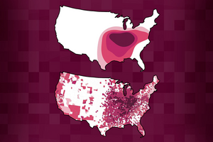 Histo spread