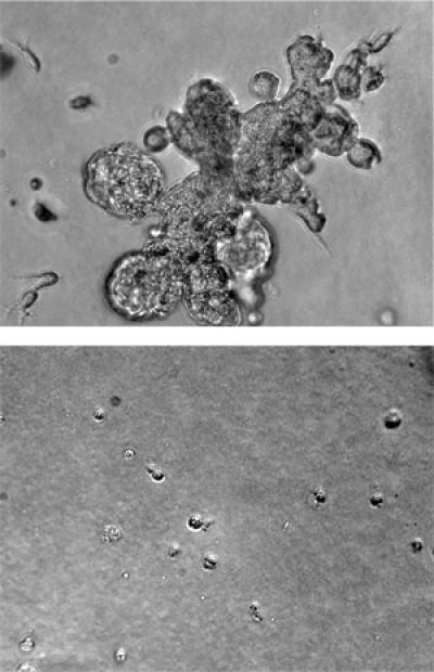 Existing Drugs May Help More Breast Cancer Patients