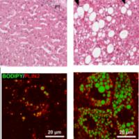 Comparison between liver biopsies and in vitro differentiated cells.