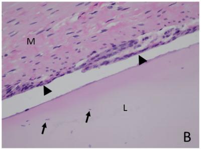 Longitudinal Section