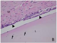 Longitudinal Section