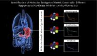 3 Subtypes of Gastric Cancer