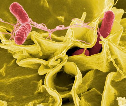 Researchers Model Impact of Vaccine Campaigns on Invasive <em>Salmonella</em>