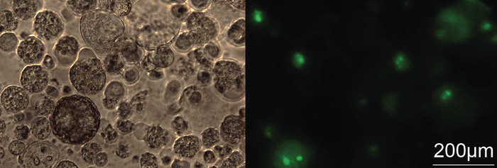 Microscopy pictures of three-dimentional lung cancer spheroids transfected with green fluorescent-labelled ASOs.