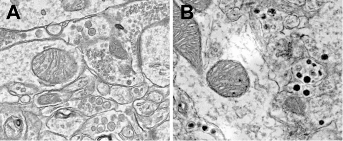 Amygdala microscopy