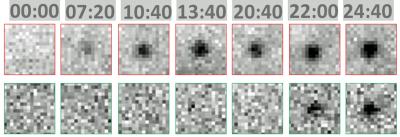 Gag Assembly and ALIX Recruitment in HIV Budding