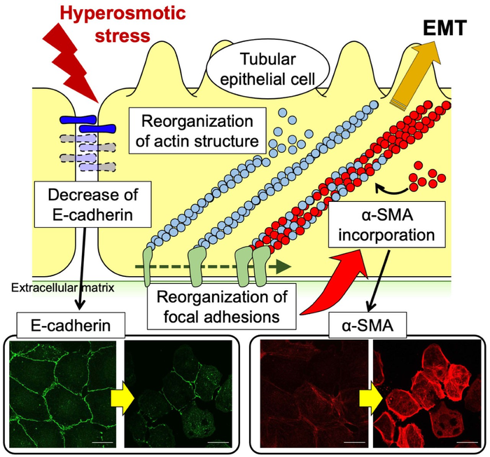 The pathway to EMT in mannitol treatment