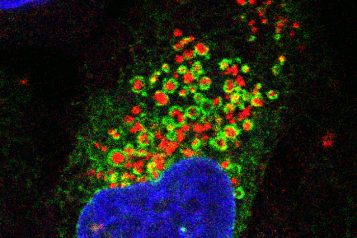 Fluorescence microscopy images showing the endoplasmic reticulum network (green) wrapping around damaged lysosomes (red). The cell nucleus is shown in blue.