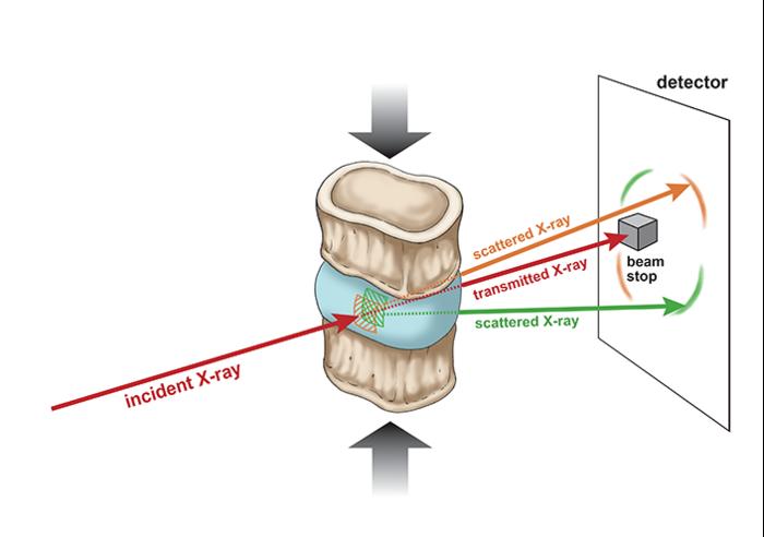 The in situ synchrotron small-angle x-ray scattering compression setup