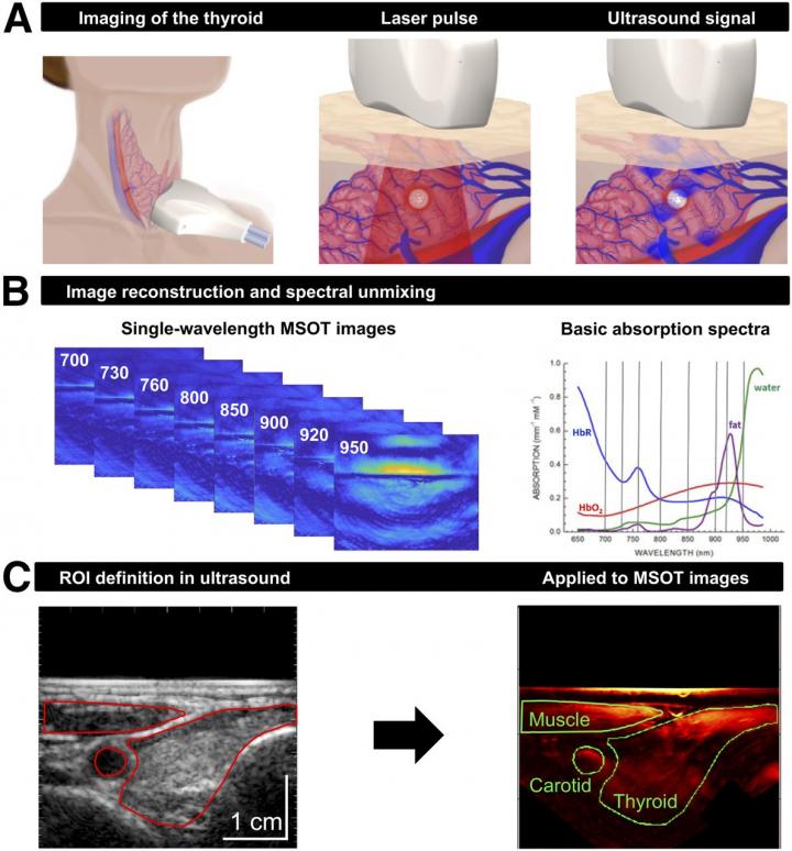 Principles of Clinical Multispectral Optoacoustic Tomography of Thyroid