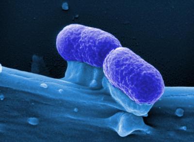 <i>E. coli</i>