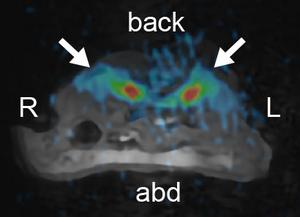 Sodium magnetic resonance imaging of a mouse kidney.