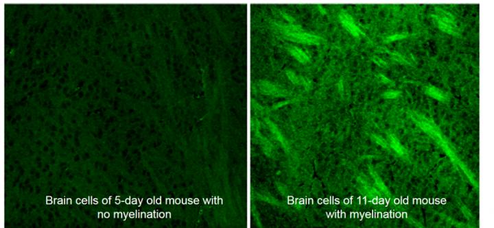 Fat Formation in Brain Cells of Developing Mice