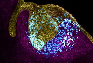 Tooth epithelium and mesenchyme