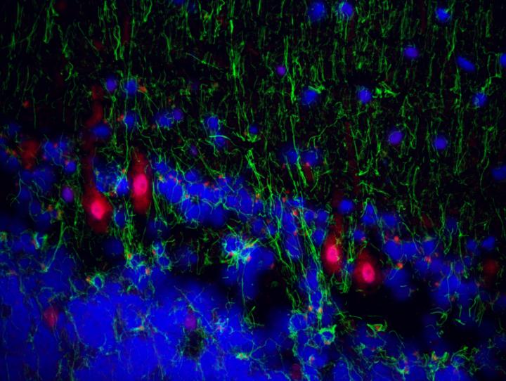 Proteins of Human Herpesviruses in Purkinje Neurons