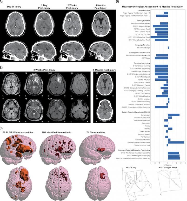 Making sense of complex brain imaging data