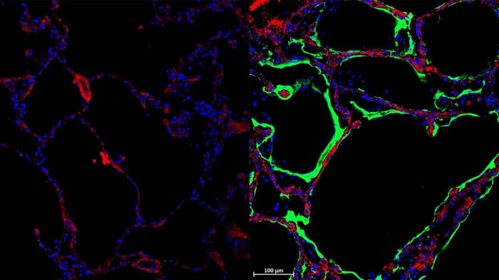 Highlighted infected lung tissue showing receptor sites