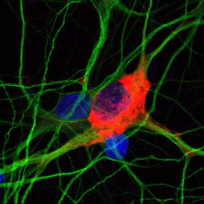 MANF: A Potential Therapeutic Strategy for Stroke Recovery (2 of 5)