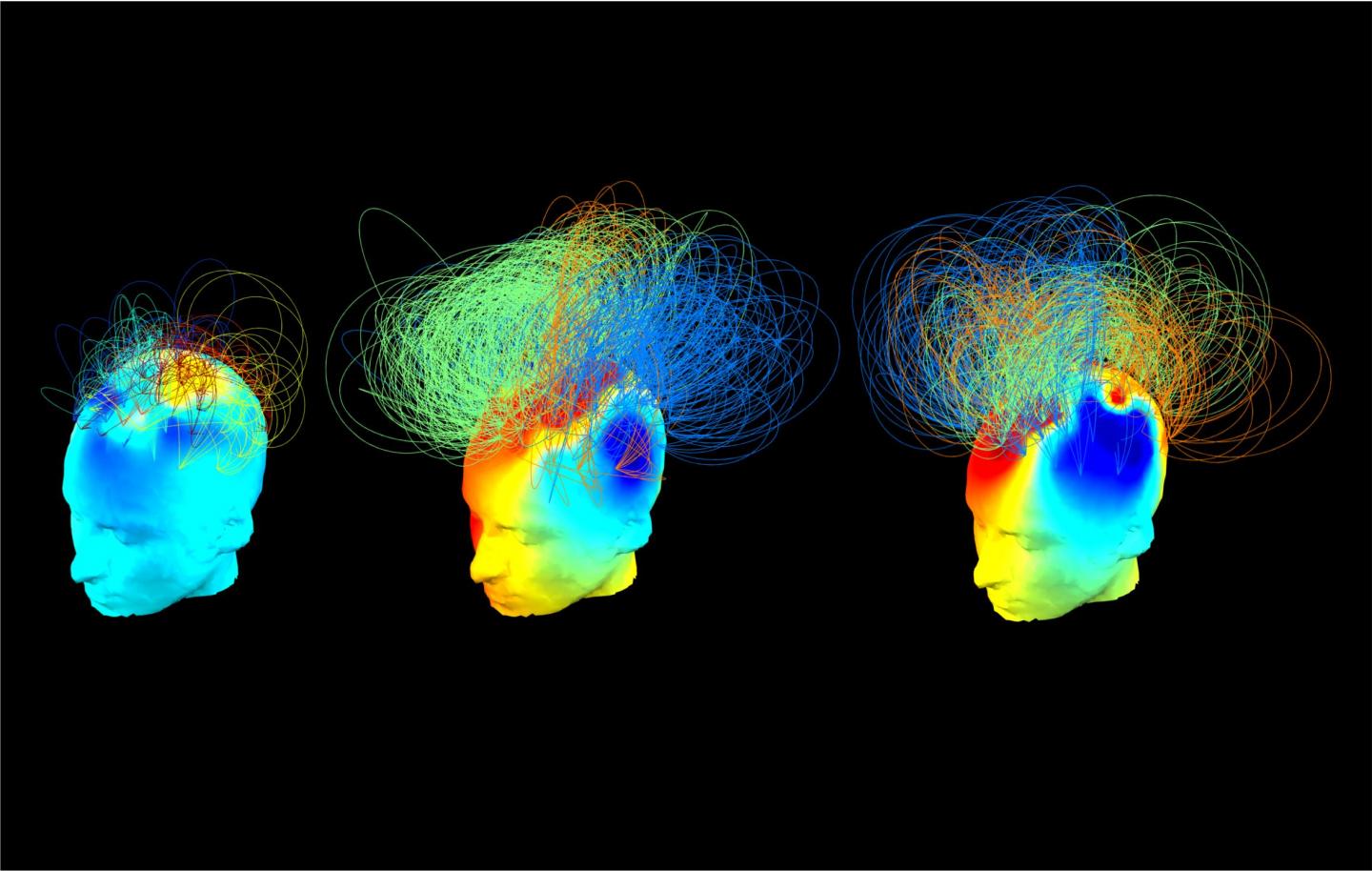 Brain Networks