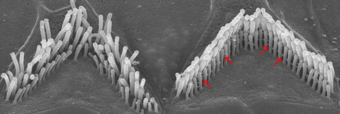 Hair cell bundles, with and without a functional stereocilin protein