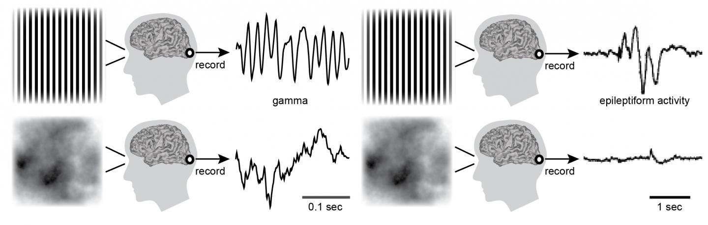 Visual Patterns that Elicit Gamma Oscillation
