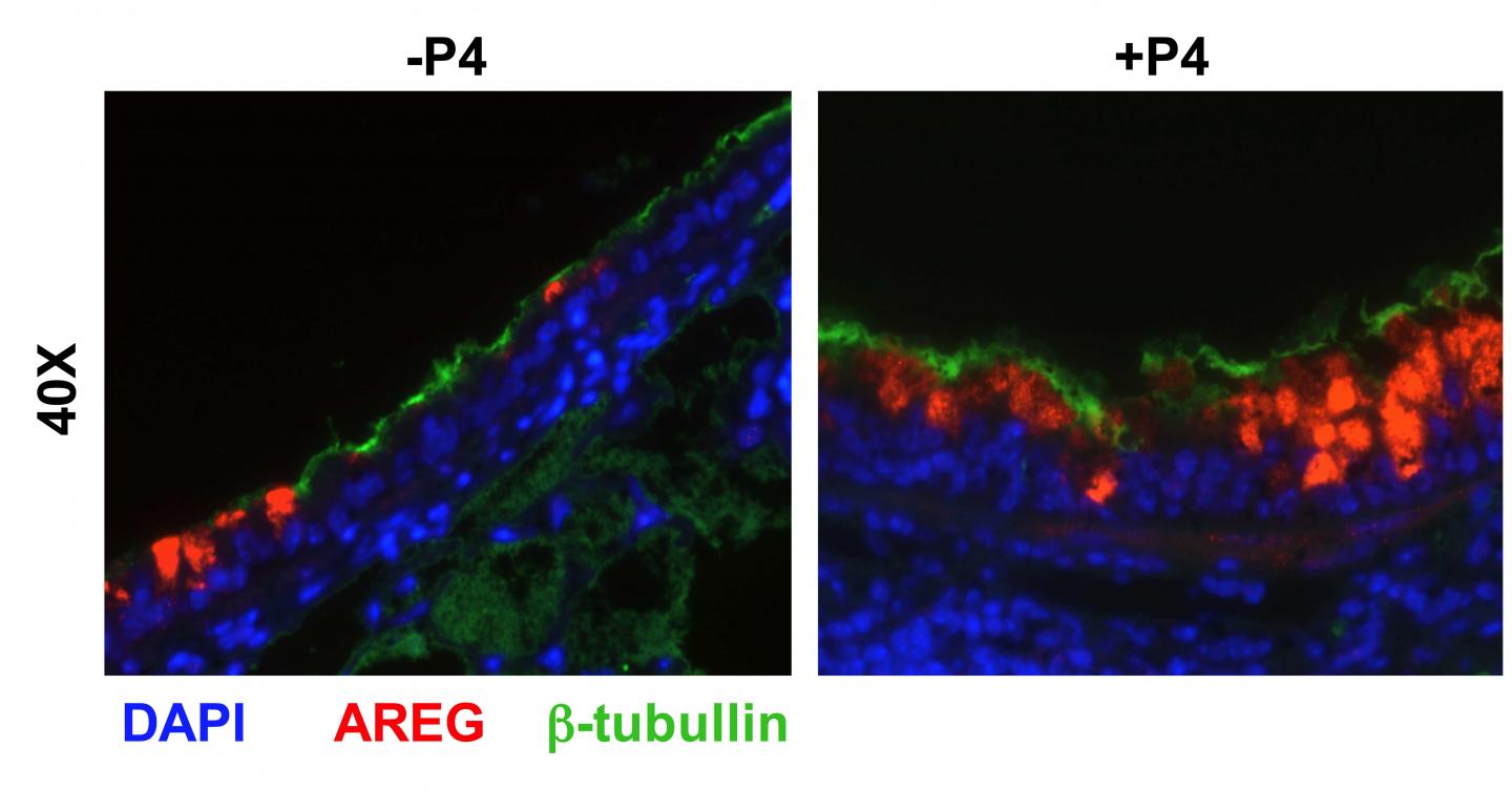Progesterone Promotes Healing in the Lung after a Bout of Flu