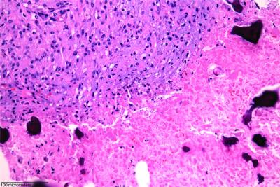 <I>C. novyi</I> (2 of 2)