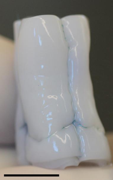 Tri-Tube Heart Valve Replacement Adapts to the Growing Heart in Lambs (1 of 3)