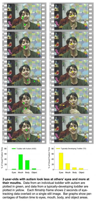 Toddlers' Focus on Mouths Rather Than on Eyes is a Predictor of Autism Severity