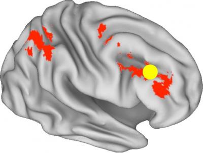 Brain Activity in Reward Motivation