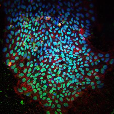 Discovery of Reprogramming Signature May Help Overcome Barriers to Stem Cell-Based Regenerative Medi