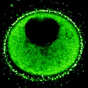 Sea star oocyte with   fluorescent Vitellogenin-GFP