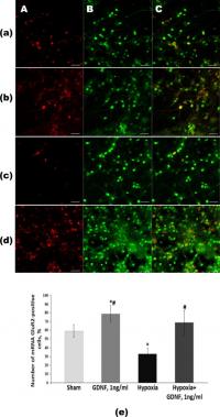 Detection of GluR2 mRNA-positive Cells in Primary Hippocampal Cultures