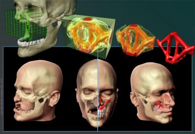 Topology Optimization for Facial Reconstruction