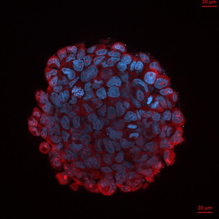 3D Tumor Spheroid Model Showin [IMAGE] | EurekAlert! Science News Releases