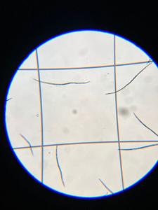 North American Beech Leaf Disease Nematodes under a microscope