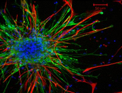 Olfactory Ensheathing Cells