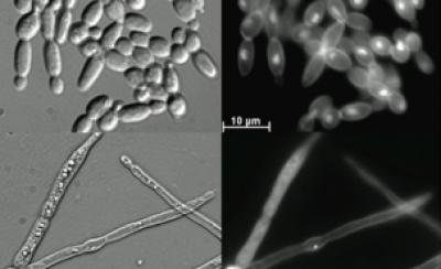 Vitamin B3 as a Novel Approach to Treat Fungal Infections