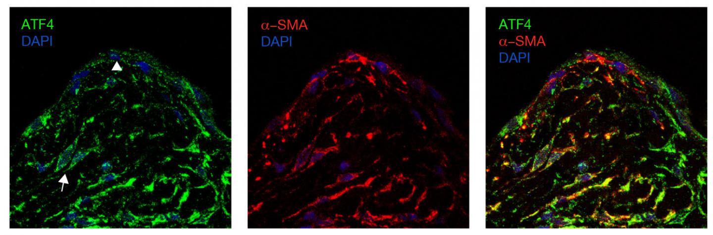 How Production of an Amino Acid Drives Harmful Fibrosis in the Lungs (1 of 1)