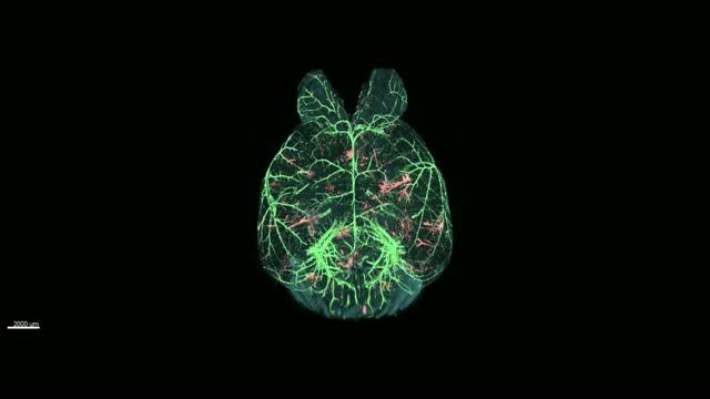 Whole-Brain Imaging of Cancer Metastasis